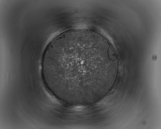 X0000100490059200806201702