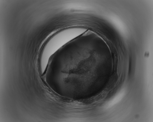 X0000100490387200806201657