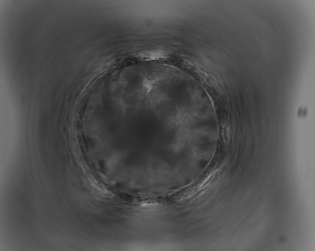 X0000100491393200806201642