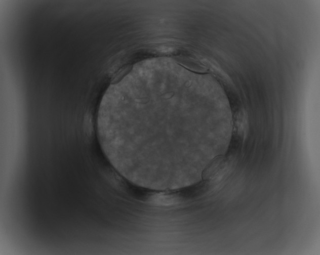 X0000100490568200807111125