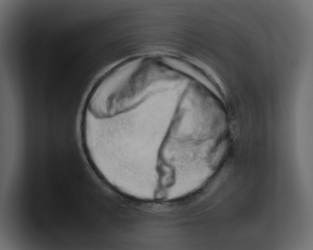 X0000100490995200807111119