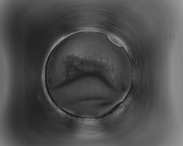 X0000100501007200806131432