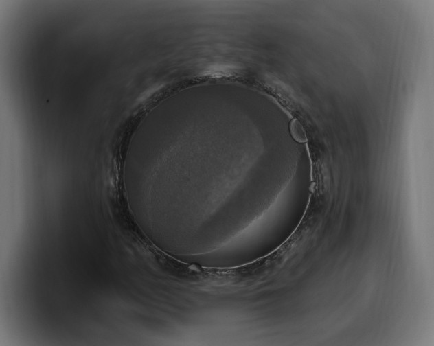 X0000100501158200806131430