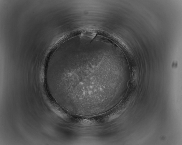 X0000100500494200806201718