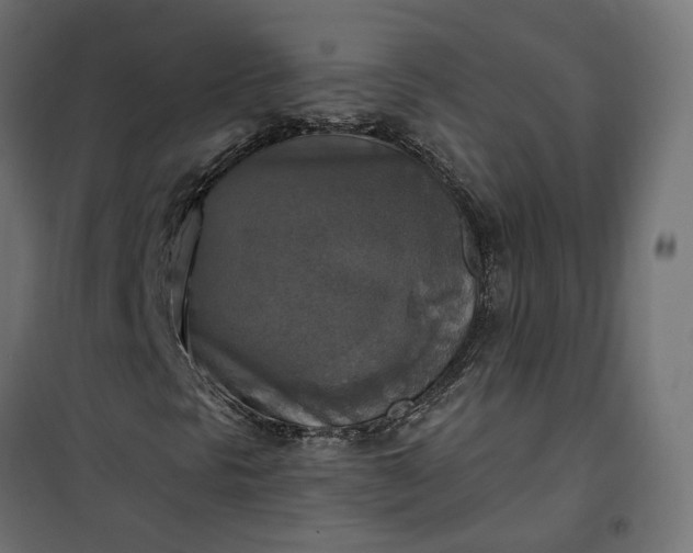 X0000100501297200806201706