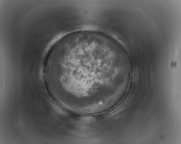 X0000100501454200806201704