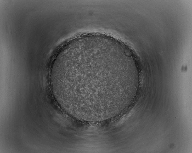 X0000100501494200806201703