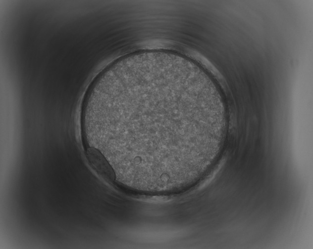 X0000100500986200807111139