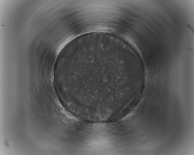 X0000100750944200807101700