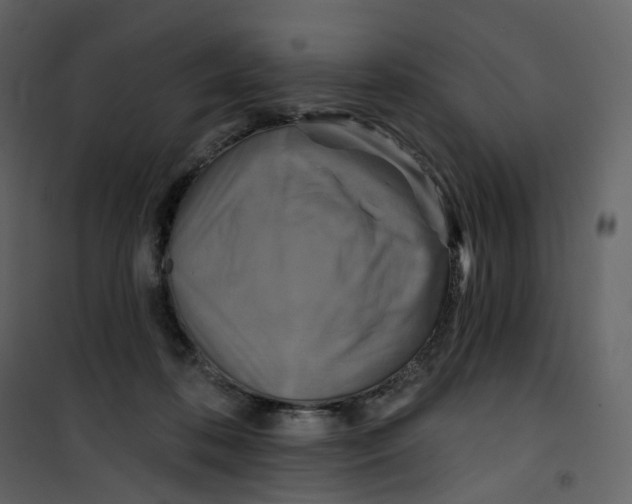 X0000100750316200807171418