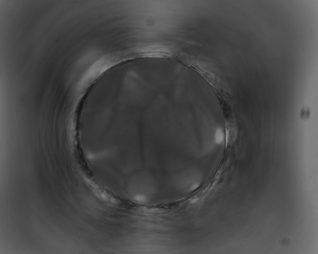X0000100750339200807171417