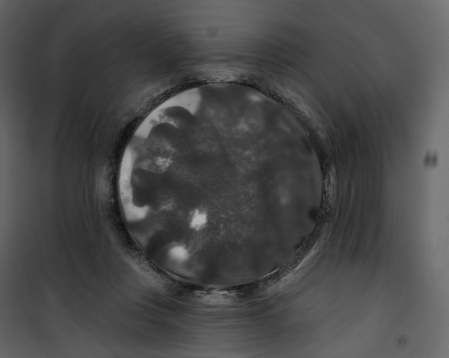 X0000100750359200807171417