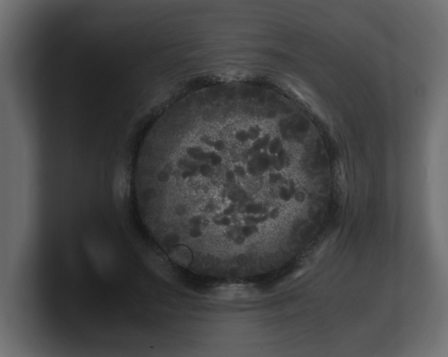 X0000100760499200806261608