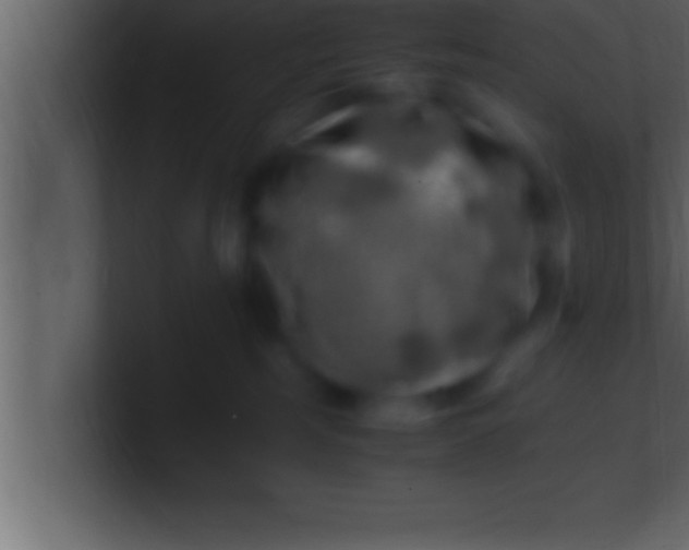 X0000100760185200807031157