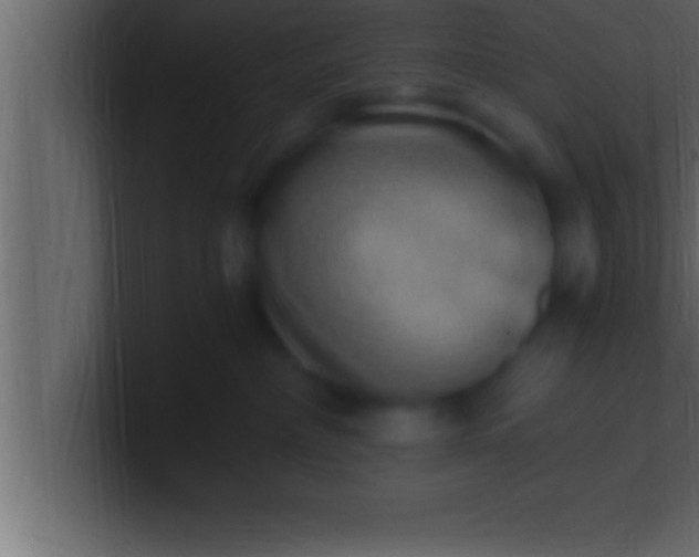 X0000100760236200807031156