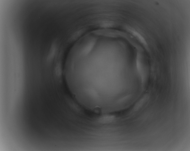 X0000100760257200807031156