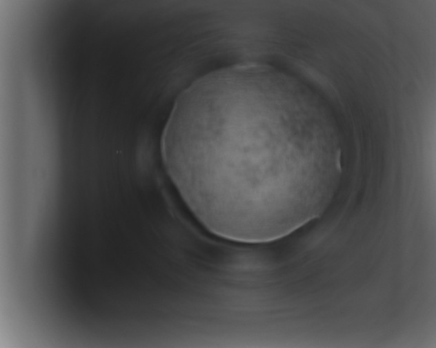 X0000100760336200807031155