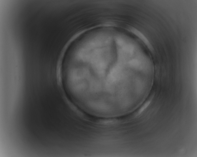 X0000100760939200807031147