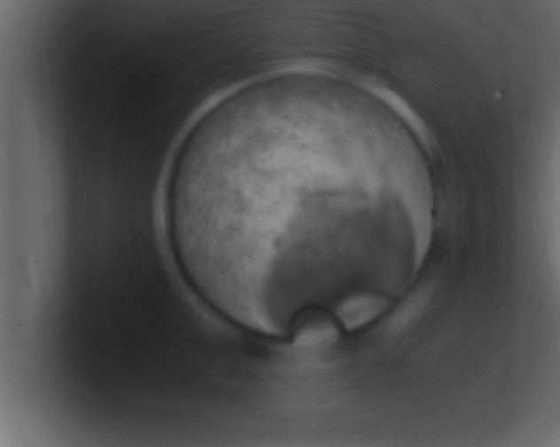 X0000100760999200807031146