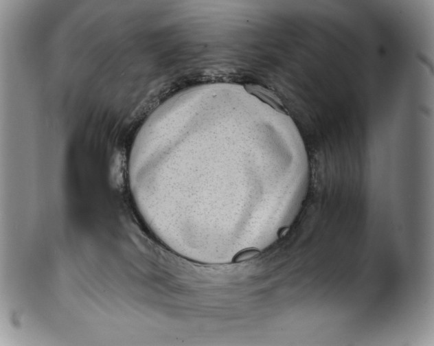 X0000100760038200807101738