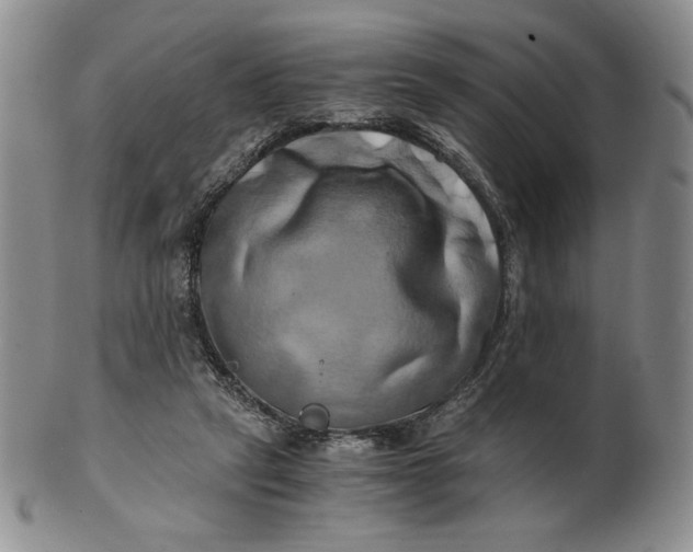 X0000100760257200807101735