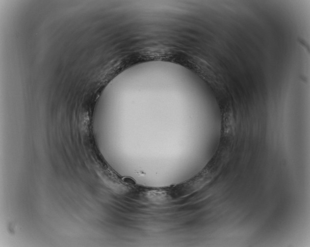 X0000100760279200807101735
