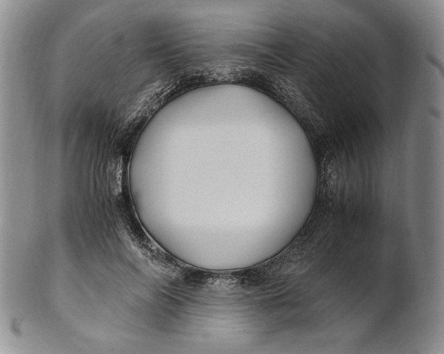 X0000100760694200807101728
