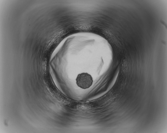X0000100760739200807101727