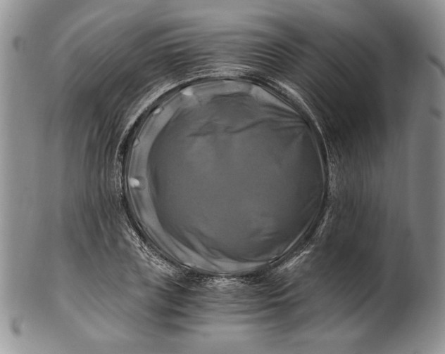 X0000100760835200807101725