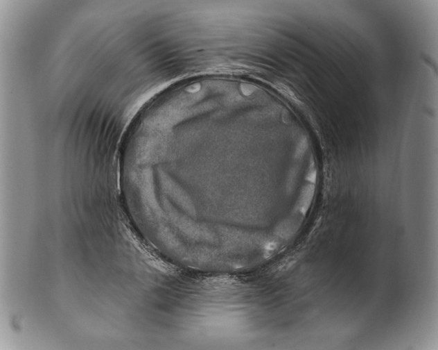 X0000100760838200807101725