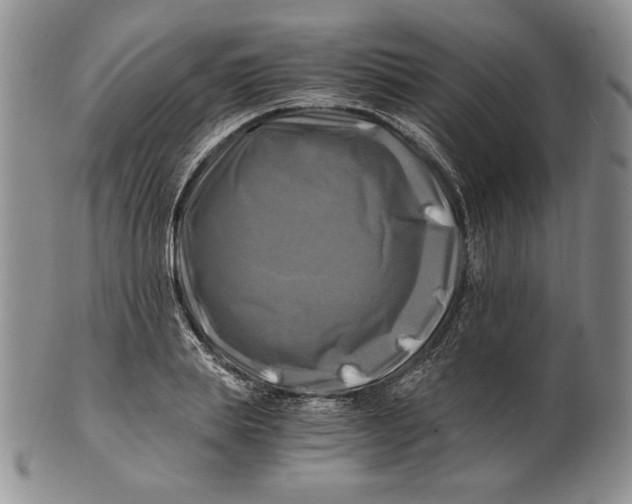 X0000100760839200807101725