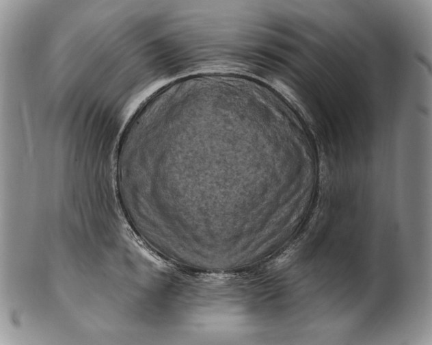 X0000100760854200807101726