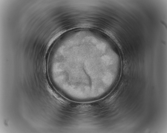 X0000100760939200807101724