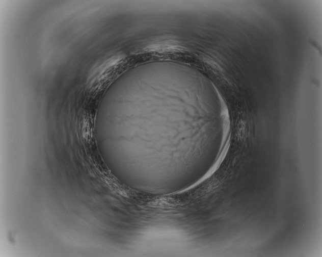 X0000100760966200807101723