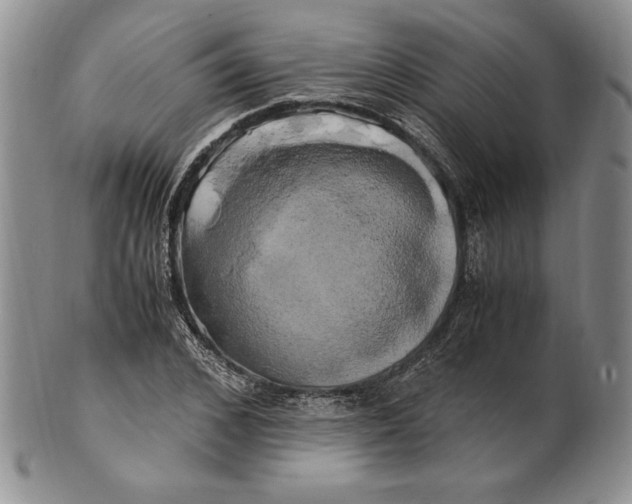 X0000100760976200807101723