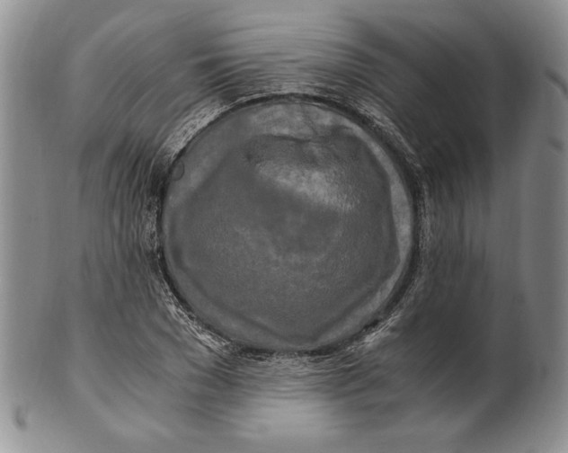 X0000100760977200807101723