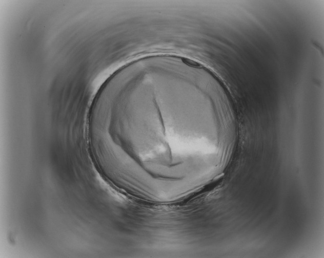 X0000100761527200807101715