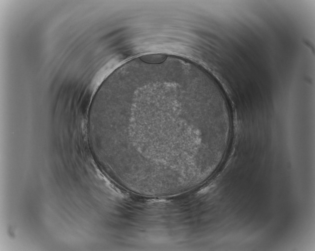 X0000100761529200807101715