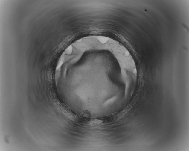 X0000100760257200807171348