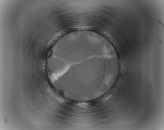 X0000100760357200807171347