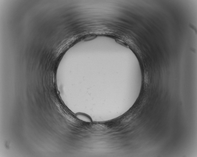 X0000100760397200807171346