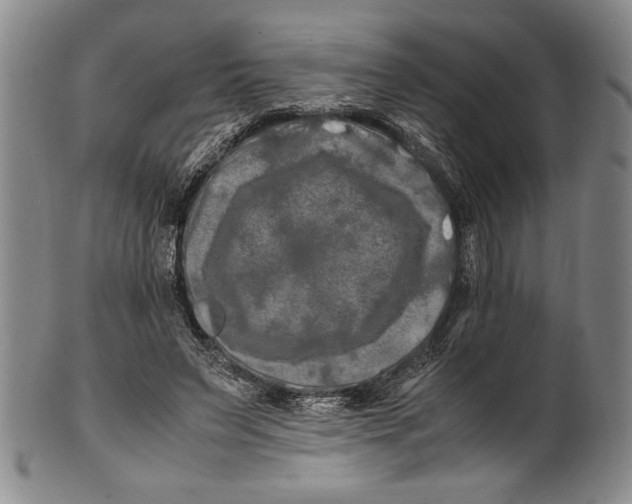 X0000100760495200807171345