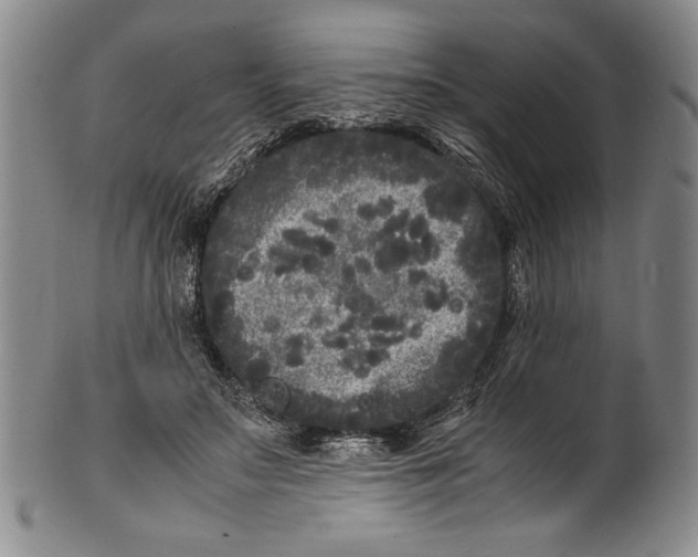 X0000100760499200807171345