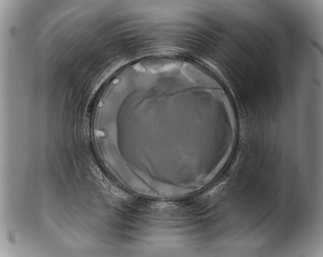 X0000100760835200807171340