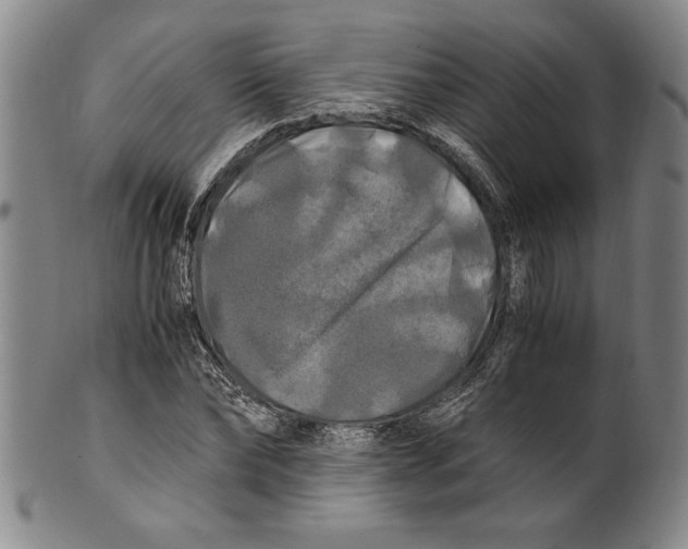 X0000100760878200807171339
