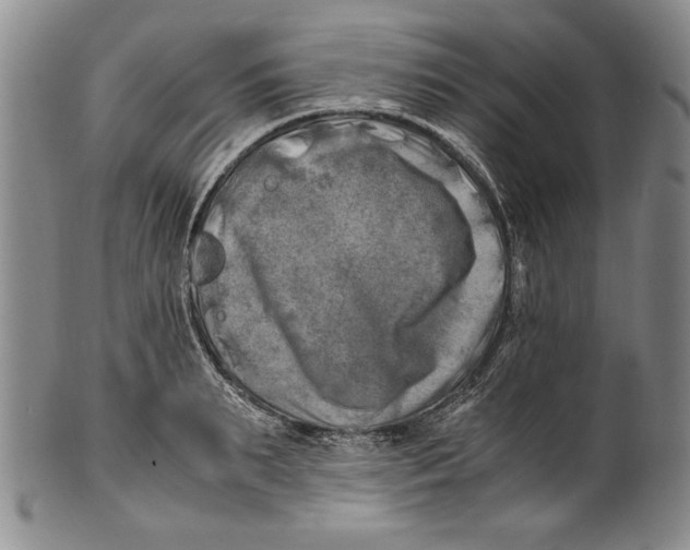 X0000100760895200807171339