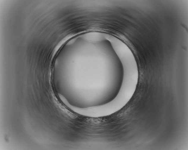 X0000100760955200807171339