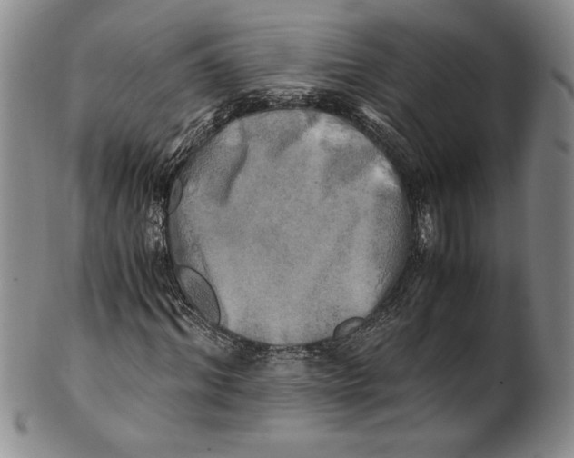 X0000100760964200807171338