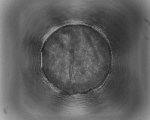 X0000100761175200807171335