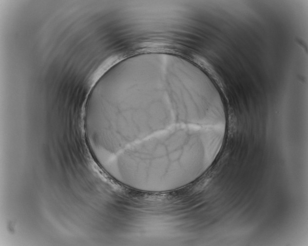 X0000100761386200807171332